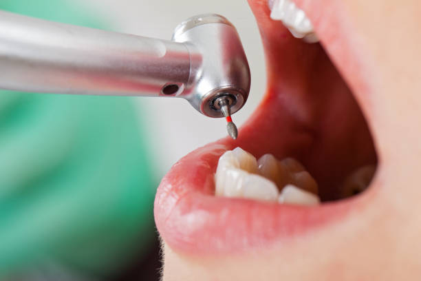 Best Emergency Dental Care for Abscessed Tooth in Pecos, TX